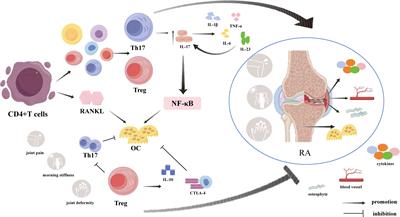 Research progress of targeted therapy regulating Th17/Treg balance in bone immune diseases